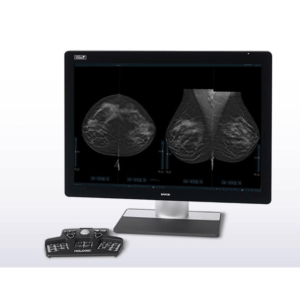 Hologic 3DQuorum™ Imaging Technology, powered by Genius AI™