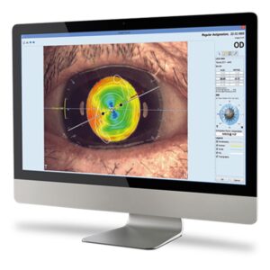 EyeSuite IOL