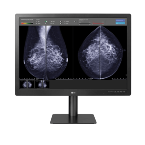 LG 31" 12MP IPS Diagnostic Monitor for Mammography