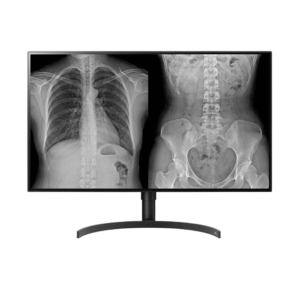 LG 31.5" 8MP Diagnostic Monitor