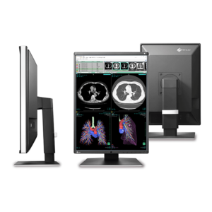 Radiforce RX360