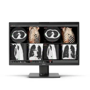 Nio-8MP-front-onwhite-03 (1)